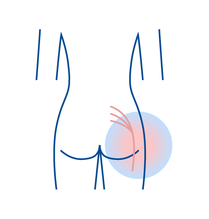 Sciatica Treatment icon